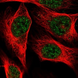 C19orf47 Antibody, Novus Biologicals:Antibodies:Primary Antibodies